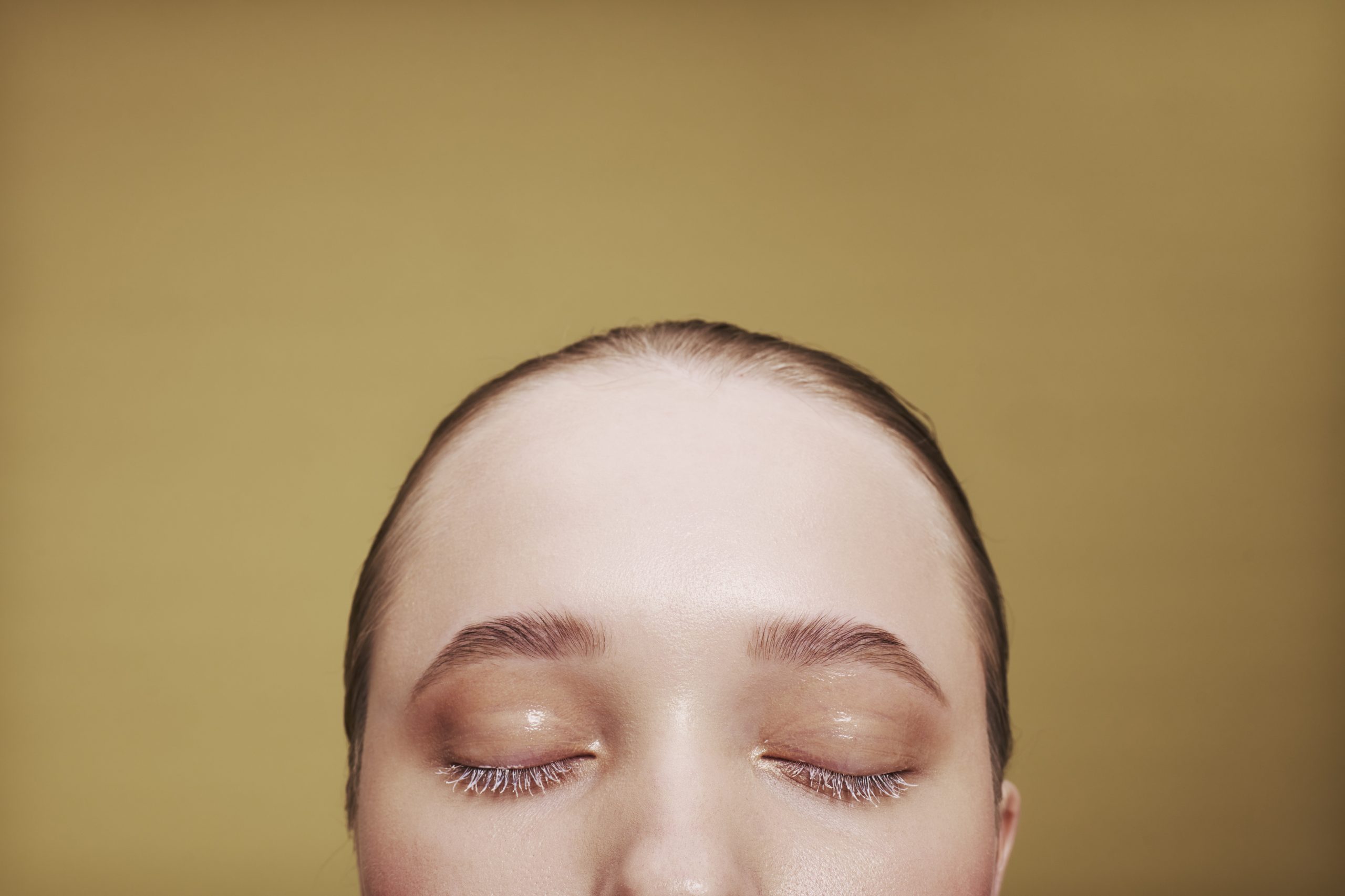 Подтяжка лба